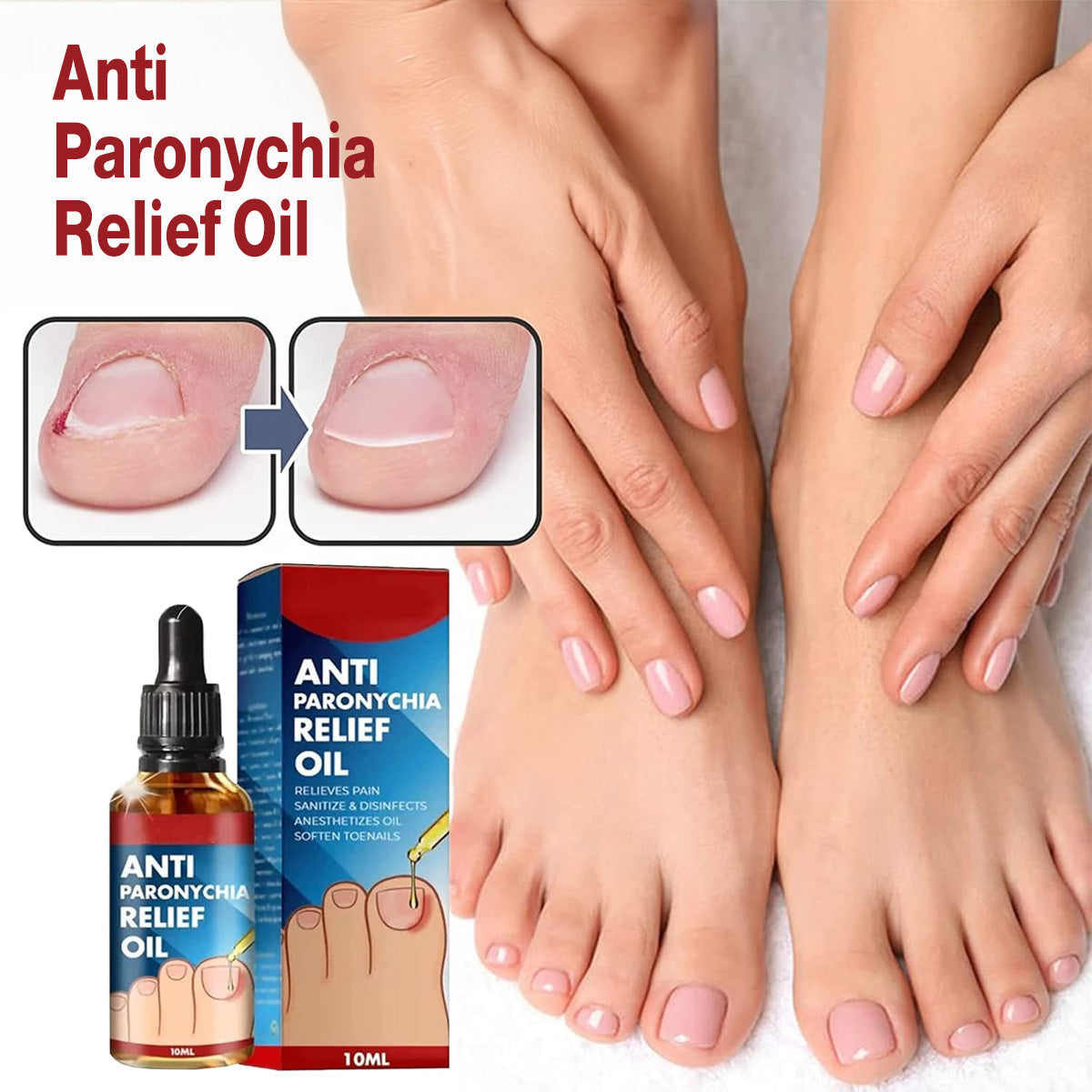 Anti Paronychia Relief Oil & Ingrown Toenail Corrector Fungal Nail & Pain Treatment Drops