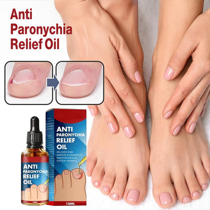 Anti Paronychia Relief Oil & Ingrown Toenail Corrector Fungal Nail & Pain Treatment Drops