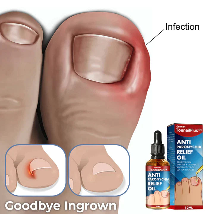 Anti Paronychia Relief Oil & Ingrown Toenail Corrector Fungal Nail & Pain Treatment Drops